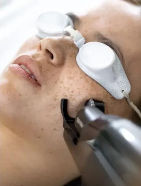 ClearLift NovaLux Treatment Small